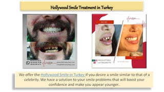 Hollywood Smile Treatment in Turkey
 