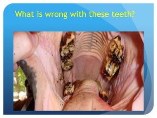 What is wrong with these teeth?
 