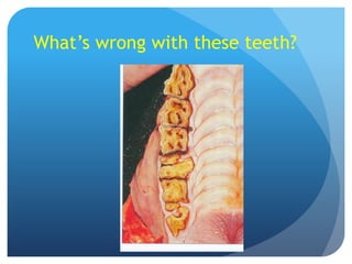 What’s wrong with these teeth?
 