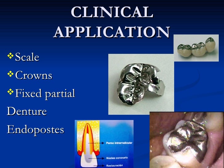 Dentistry (metals)