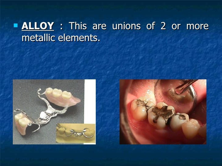 Dentistry (metals)