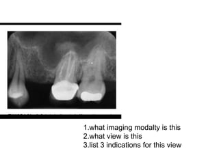 1.what imaging modalty is this
2.what view is this
3.list 3 indications for this view
 