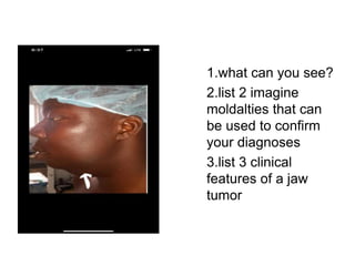 1.what can you see?
2.list 2 imagine
moldalties that can
be used to confirm
your diagnoses
3.list 3 clinical
features of a jaw
tumor
 