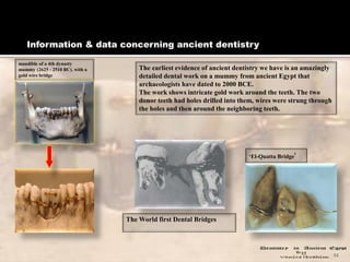 Information & data concerning ancient dentistry
11
The earliest evidence of ancient dentistry we have is an amazingly
deta...