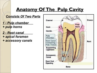 Anatomy Of The Pulp CavityAnatomy Of The Pulp Cavity
1 - Pulp chamber
+ pulp horns
2 - Root canal
+ apical foramen
+ accessory canals
Consists Of Two Parts
Pulp
Horn
 