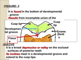 It is foundfound in the bottom of developmental
groove.
ResultsResults from incomplete union of the
primary lobes.
It is a faultfault in enamel.
3-FISSURE:
It is a broad depression or valleydepression or valley on the occlusal
surfaces of posterior teeth.
Its inclinesIts inclines meet in a developmental groove and
extend to the cusp tips.
SULCUS:
Cusp
tip
Cusp tip
Denti
n
Ename
l
Fissur
e
Developmen
tal groove
 