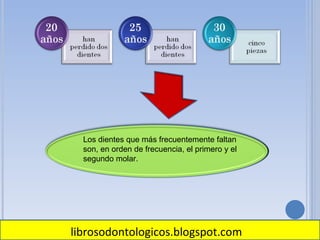   Los dientes que más frecuentemente faltan son, en orden de frecuencia, el primero y el segundo molar. librosodontologicos.blogspot.com 