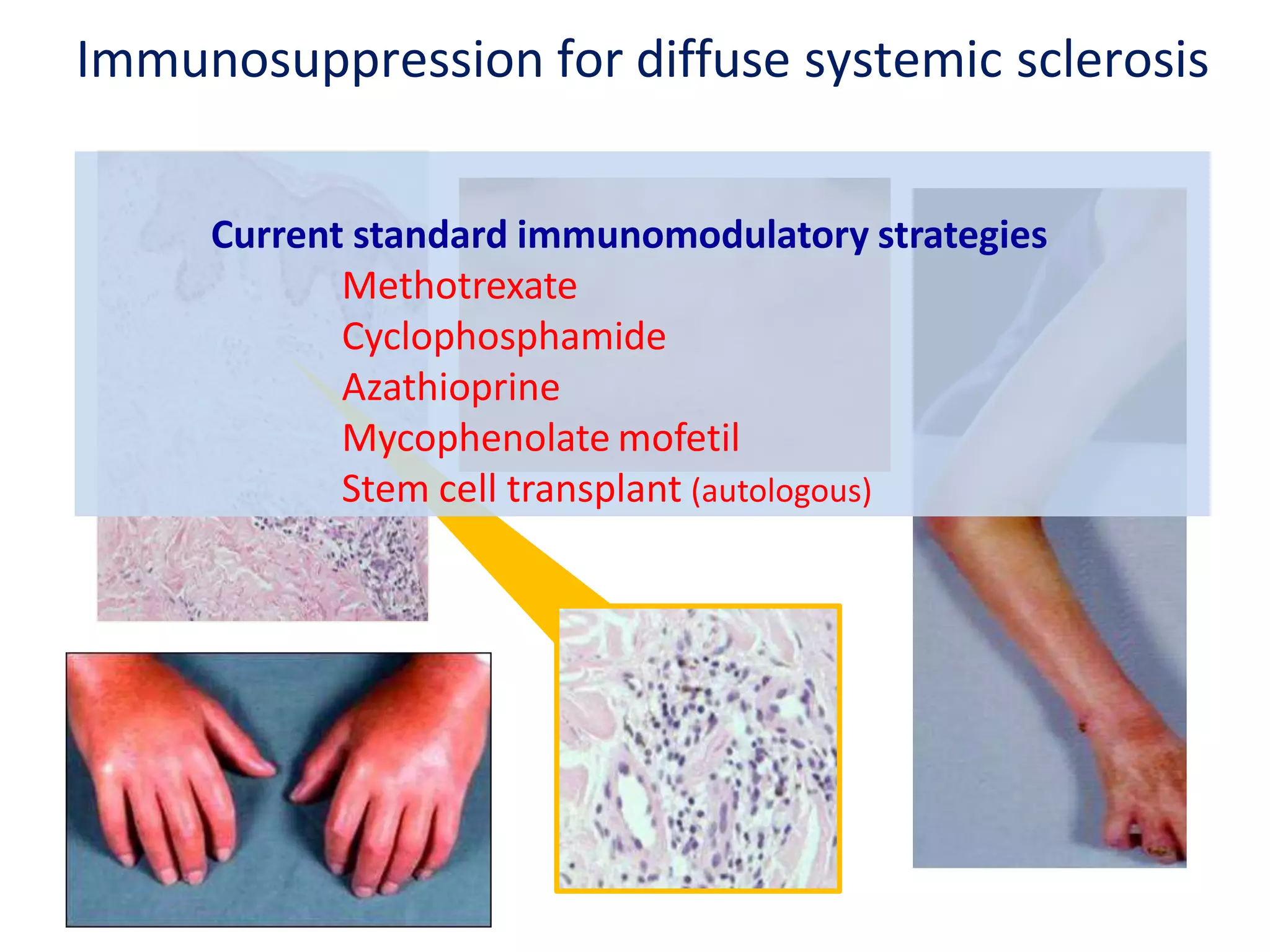 The State of Scleroderma Clinical Trials | PPTX