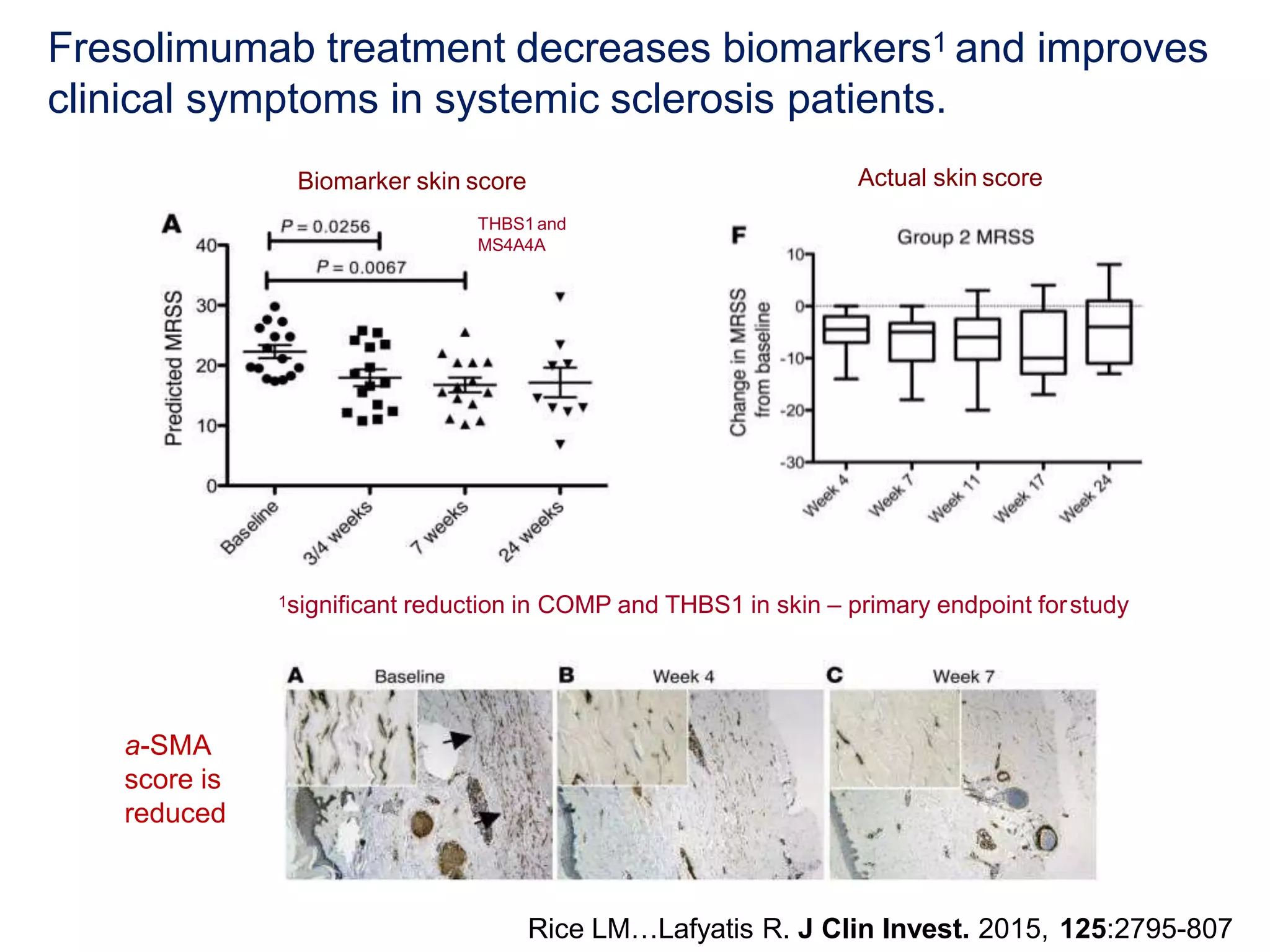 The State of Scleroderma Clinical Trials | PPTX