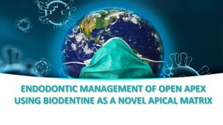 ENDODONTIC MANAGEMENT OF OPEN APEX
USING BIODENTINE AS A NOVEL APICAL MATRIX
 