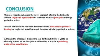 CONCLUSION
This case report emphasizes the novel approach of using Biodentine to
achieve single visit apexification of the cases with an open apex and large
periapical lesion.
The use of Biodentine has been demonstrated to induce faster periapical
healing for single visit apexification of the cases with large periapical lesions.
Although the efficacy of BioDentine as a dentin substitute is yet to be
clinically proven for its therapeutic indications, it may be a promising
material for apexification.
 