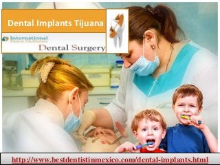 Dental Implants Tijuana
http://www.bestdentistinmexico.com/dental-implants.html
 