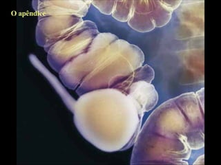 O apêndice