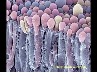 Células do plexo coróide