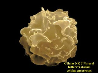 Células NK (“Natural Killers”) atacam células cancerosas