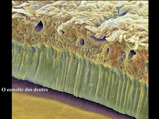 O esmalte dos dentes