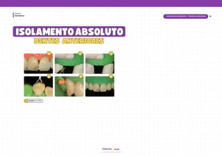 hud
Odonto
Dentística
Módulo
ISOLAMENTO
ISOLAMENTOABSOLUTO
ABSOLUTO
1
1 2
2 3
3
4
4
10
Isolamento absoluto - Dentes anteriores
DENTES ANTERIORES
DENTES ANTERIORES
5
5 6
6
Baratieriet al. (2010)
 