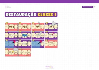 hud
Odonto
Dentística
Módulo
RESTAURAÇÃO
RESTAURAÇÃO CLASSE I
CLASSE I
1
1 2
2 3
3 4
4
5
5 6
6 7
7 8
8
9
9 10
10 11
11 12
12
13
13 14
14
15
Restauração Classe I
 
