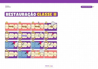 hud
Odonto
Dentística
Módulo
CLASSE II
CLASSE II
RESTAURAÇÃO
RESTAURAÇÃO
1
1 2
2 3
3 4
4
5
5 6
6 7
7 8
8
9
9 10
10 11
11 12
12
13
13 14
14 15
15 16
16
20
Restauração Classe II
 