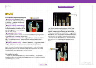 Dentística
Módulo
hud
Odonto
Características gerais do preparo
Expulsividade: o preparo deve
ser realizado de forma que permita
a remoção e inserção da restaura-
ção com facilidade.
Ângulos Internos arredondados:
ângulos internos devem ser arredon-
dados para evitar concentrações de
estresse e garantir melhor adapta-
ção da restauração.
Margens bem delimitadas:
as margens do preparo devem ser claramente definidas para garantir
uma adaptação precisa da restauração.
Espessura para cerâmica: deve-se garantir uma espessura mínima
de 1,5 mm para a cerâmica, proporcionando resistência suficiente à
restauração.
Ausência de áreas frágeis: o preparo deve evitar a criação de áreas
frágeis na estrutura dental remanescente para prevenir fraturas.
Essas características são essenciais para assegurar a durabilidade e
eficácia das restaurações tipo inlay, além de proporcionar um ajuste
adequado e uma longevidade clínica satisfatória.
- As pontas diamantadas possuem bordas arre-
dondadas para criar ângulos internos suaves no
preparo, prevenindo concentrações de estresse.
- Angulação de 12° (6° em cada lado): a angulação
é projetada para garantir expulsividade adequada,
facilitando a inserção e remoção da restauração.
- Disponíveis em diferentes níveis de abrasividade
para permitir um preparo eficiente e preciso do
dente.
maisinformações
informações
44
Restaurações estéticas indiretas
INLAY
INLAY
Pontas diamantadas
- Variam em diâmetro, forma e angulação conforme a necessidade
do preparo, permitindo adaptações específicas para diferentes tipos de
cavidades e restaurações.
Baratieriet al. (2010)
Baratieriet al. (2010)
Baratieriet al. (2010)
 