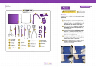 Dentística
Módulo
hud
Odonto
05
01
02
03 04
06
07
08
09
10
11
12
13
14
01
Lençol de
borracha
06 Tesoura
02 Arco de
young
03 Sugador
04 Lubrificante
05 Fio dental
07 Sonda
exploradora
08 Pinça clínica
09 Espelho bucal
10 Espátula de
inserção nº 1
11 Porta gram-
po palmer
12 Perfurador
de Ainsworth
13 Grampos
14 Caneta
check-list
06
Isolamento absoluto
Passos
Dentes posteriores
Exemplo
Lesão de cárie oclusal no primeiro molar inferior
esquerdo.
Para simplificar a preparação e restauração, é
sugerido que o grampo não seja diretamente
adaptado ao dente a ser restaurado, optando-
se, nesse caso, pelo segundo molar inferior.
Inicia-se então com a adaptação do dique de
borracha ao arco de Young, prendendo-o às
garras existentes.
O conjunto arco/lençol é colocado na cavida-
de bucal e o dique é pressionado contra os
dentes a serem isolados, marcando cada um
deles com uma caneta úmida.
É indicado que a ordem de marcação seja do
último dente (nesse caso 2º molar inferior) em
direção à linha média, é destacada.
Estender o isolamento até o hemiarco oposto
também é recomendada para melhorar o
acesso e a visualização
01
02
03
04
05
02 03
04 05
Baratieriet al. (2010)
 