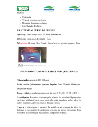 Técnica
 Profilaxia
 Teste de contatos proximais
 Remoção de arestas cortantes
 Lubrificação dos lábios
HÁ 3 TÉCNICAS DE USO DO GRAMPO
1) Grampo (com asas) + Arco + Lençol de borracha.
2) Grampo (sem Asas), Borracha + Arco
3) Ingraham: Grampo (Sem Asas) + Borracha e em seguida o porta – dique
.
PREPARO DE CAVIDADE CLASSE I PARA (AMÁLGAMA)
Alta rotação: Acima de 280 000 rpm
Baixa rotação (micromotor e contra ângulo): Entre 25 000 a 35 000 rpm
Brocas laminadas
Brocas esféricas usadas para remoção de cárie # 2,4,6,8, 10, 12, ½,1/4, 1.
O amálgama dentário é formado pela mistura de mercúrio líquido com
partículas sólidas de uma carga contendo prata, estanho e cobre, além de
outros elementos, entre os quais se destaca o zinco.
A prata contribui para o aumento da resistência da restauração, além de
diminuir o escoamento do amálgama sob ação de cargas mecânicas. Esse
metal tem a desvantagem de aumentar a expansão de presa.
 