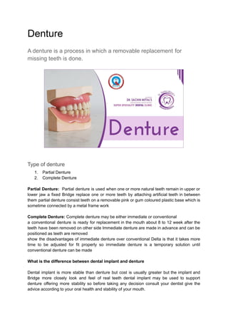 Denture
A denture is a process in which a removable replacement for
missing teeth is done.
Type of denture
1. Partial Denture
2. Complete Denture
Partial Denture: Partial denture is used when one or more natural teeth remain in upper or
lower jaw a fixed Bridge replace one or more teeth by attaching artificial teeth in between
them partial denture consist teeth on a removable pink or gum coloured plastic base which is
sometime connected by a metal frame work
Complete Denture: Complete denture may be either immediate or conventional
a conventional denture is ready for replacement in the mouth about 8 to 12 week after the
teeth have been removed on other side Immediate denture are made in advance and can be
positioned as teeth are removed
show the disadvantages of immediate denture over conventional Delta is that it takes more
time to be adjusted for fit properly so immediate denture is a temporary solution until
conventional denture can be made
What is the difference between dental implant and denture
Dental implant is more stable than denture but cost is usually greater but the implant and
Bridge more closely look and feel of real teeth dental implant may be used to support
denture offering more stability so before taking any decision consult your dentist give the
advice according to your oral health and stability of your mouth.
 