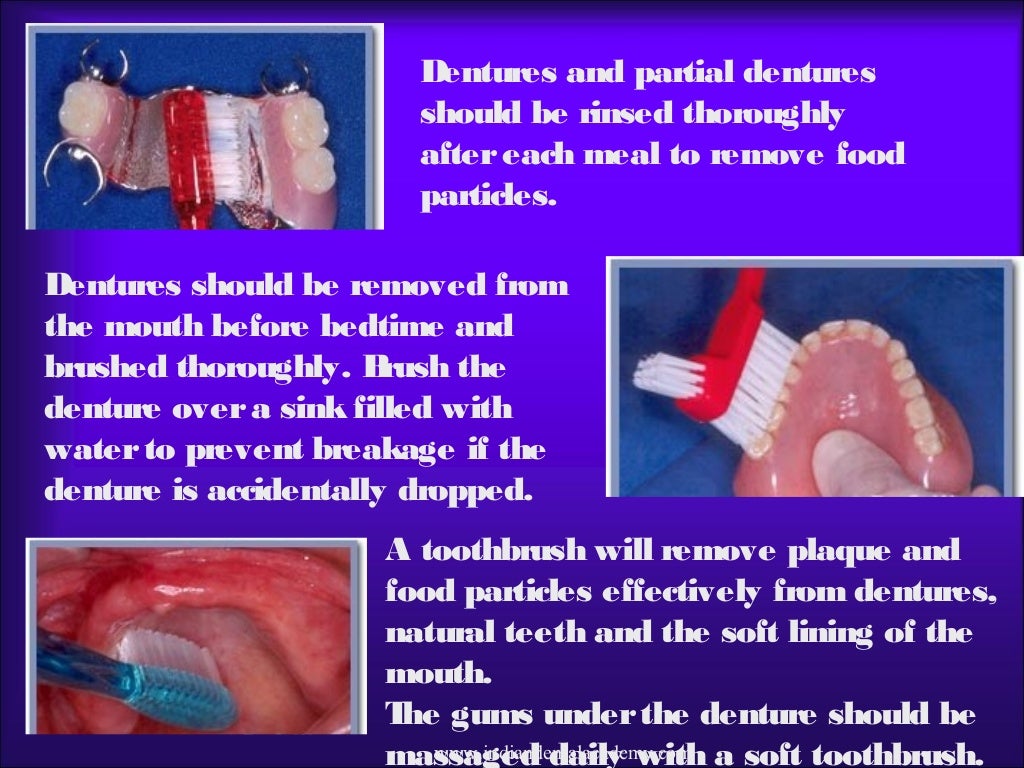 Denture adhesives and cleansers/ orthodontics information