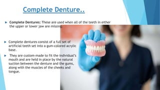  Complete dentures consist of a full set of
artificial teeth set into a gum-colored acrylic
base.
 They are custom-made to fit the individual’s
mouth and are held in place by the natural
suction between the denture and the gums,
along with the muscles of the cheeks and
tongue.
Complete Denture..
 Complete Dentures: These are used when all of the teeth in either
the upper or lower jaw are missing.
 