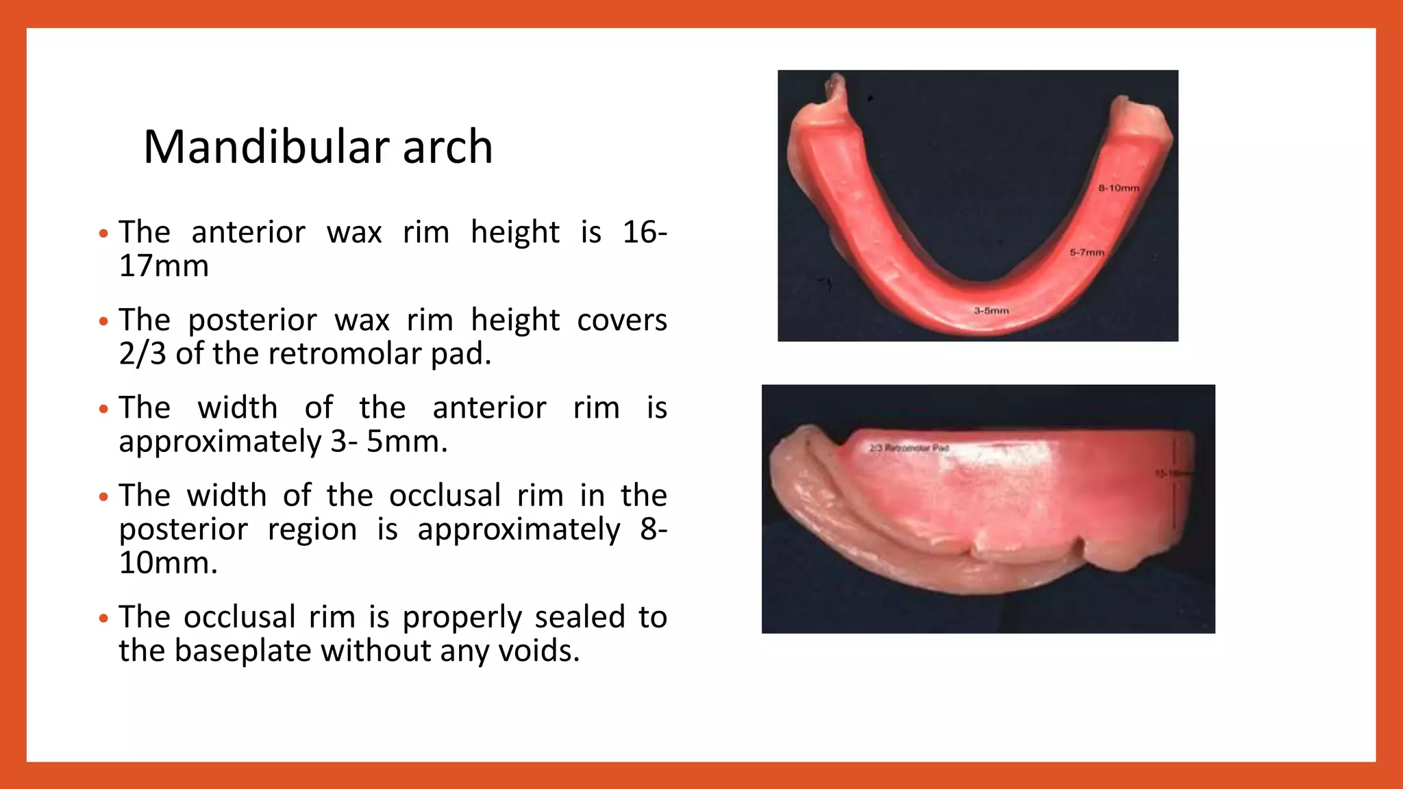 Oclusal Rim Denture base and occlusal rims | PPTX