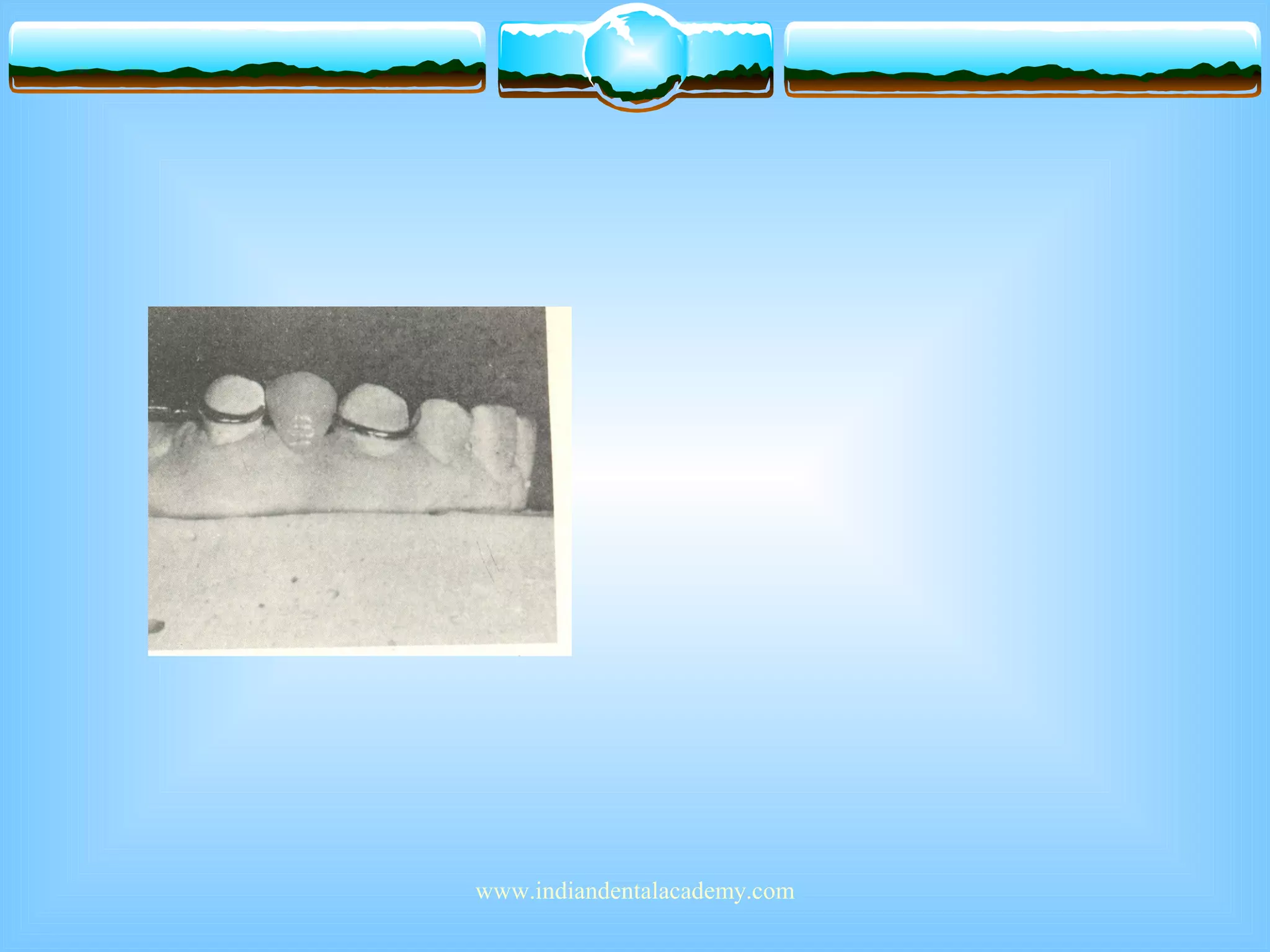 www.indiandentalacademy.com
 