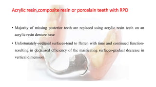Denture base considerations in rpd | PPTX