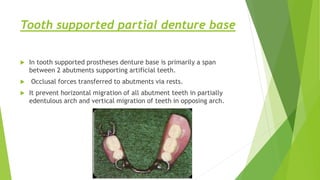 Denture base materials | PPTX
