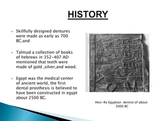    Skillfully designed dentures
    were made as early as 700
    BC.and

   Talmud a collection of books
    of hebrews in 352-407 AD
    mentioned that teeth were
    made of gold ,silver,and wood.

   Egypt was the medical center
    of ancient world, the first
    dental prosthesis is believed to
    have been constructed in egypt
    about 2500 BC.
                                       Hesi-Re Egyptian dentist of about
                                                   3000 BC
 