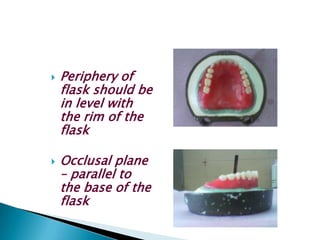    Periphery of
    flask should be
    in level with
    the rim of the
    flask

   Occlusal plane
    – parallel to
    the base of the
    flask
 