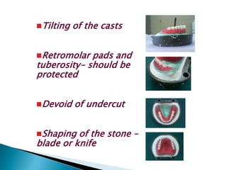 Tilting   of the casts


Retromolar  pads and
tuberosity- should be
protected


Devoid    of undercut


Shaping  of the stone –
blade or knife
 