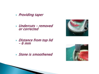    Providing taper


   Undercuts – removed
    or corrected


   Distance from top lid
    – 6 mm


   Stone is smoothened
 