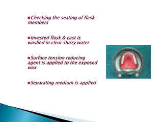 Checking   the seating of flask
members


Investedflask & cast is
washed in clear slurry water


Surface  tension reducing
agent is applied to the exposed
wax


Separating   medium is applied
 