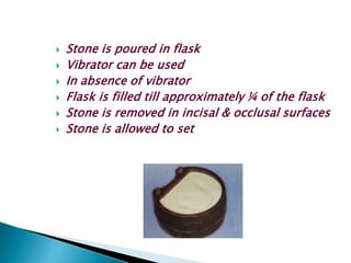    Stone is poured in flask
   Vibrator can be used
   In absence of vibrator
   Flask is filled till approximately ¼ of the flask
   Stone is removed in incisal & occlusal surfaces
   Stone is allowed to set
 