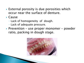    External porosity is due porosities which
    occur near the surface of denture.
   Cause
    ◦ Lack of homogeneity of dough.
    ◦ Lack of adequate pressure.
   Prevention – use proper monomer – powder
    ratio, packing in dough stage.
 