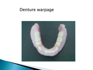 Denture warpage
 