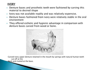 IVORY
    Denture bases and prosthetic teeth were fashioned by carving this
     material to desired shape
    Ivory was not available readily and was relatively expensive.
    Denture bases fashioned from ivory were relatively stable in the oral
     environment
    They offered esthetic and hygienic advantage in comparison with
     denture bases carved from wood or bone.




    Carved ivory upper denture retained in the mouth by springs with natural human teeth
        cut off at the
    Neck and riveted at the base.
 