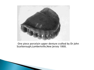 One piece porcelain upper denture crafted by Dr John
Scarborough,Lambertville,New Jersey 1868.
 