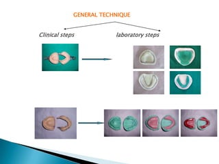 GENERAL TECHNIQUE


Clinical steps           laboratory steps
 