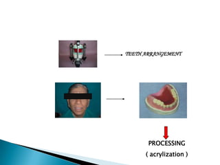 TEETH ARRANGEMENT




       PROCESSING
      ( acrylization )
 