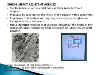 3)HIGH IMPACT RESISTANT ACRYLIC
     Similar to heat cured material but less likely to be broken if
      dropped.
     Produced by substituting the PMMA in the powder with a copolymer.
     Copolymer of butadiene with styrene or methyl methacrylate are
      incorporated into the beads.
     Phase inversion resulting in dispersion throughout the beads of tiny
      islands of rubber containing small inclusions of rubber/PMMA graft
      polymer.




Electron micrograph of high impact denture
Base showing size and shape of polystyrene-butadiene
Rubber inversion phase.
 