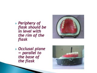 🞂​ Periphery of
flask should be
in level with
the rim of the
flask
🞂​ Occlusal plane
– parallel to
the base of
the flask
 