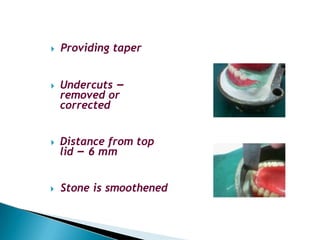 🞂​ Providing taper
🞂​ Undercuts –
removed or
corrected
🞂​ Distance from top
lid – 6 mm
🞂​ Stone is smoothened
 