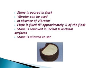 🞂​ Stone is poured in flask
🞂​ Vibrator can be used
🞂​ In absence of vibrator
🞂​ Flask is filled till approximately ¼ of the flask
🞂​ Stone is removed in incisal & occlusal
surfaces
🞂​ Stone is allowed to set
 