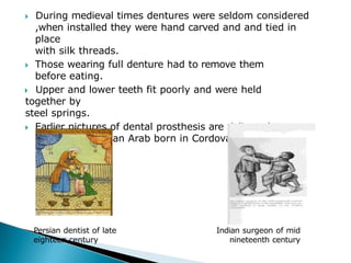 🞂​ During medieval times dentures were seldom considered
,when installed they were hand carved and and tied in
place
with silk threads.
🞂​ Those wearing full denture had to remove them
before eating.
🞂​ Upper and lower teeth fit poorly and were held
together by
steel springs.
🞂​ Earlier pictures of dental prosthesis are delivered to us
by ABUL-CASIM an Arab born in Cordova Spain.
Persian dentist of late
eighteen century
Indian surgeon of mid
nineteenth century
 